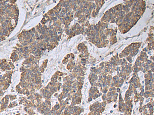 Anti-CCNF Rabbit Polyclonal Antibody
