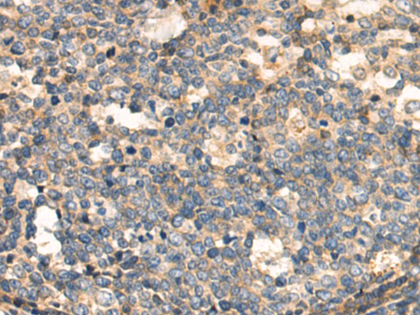 Anti-PKA C beta Rabbit Polyclonal Antibody