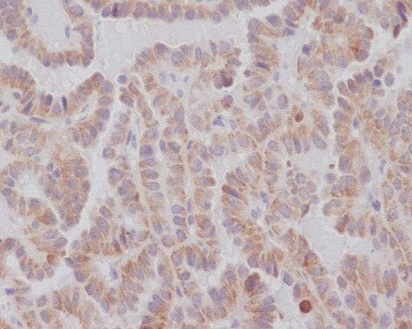Anti-KIFC1 Rabbit Polyclonal Antibody