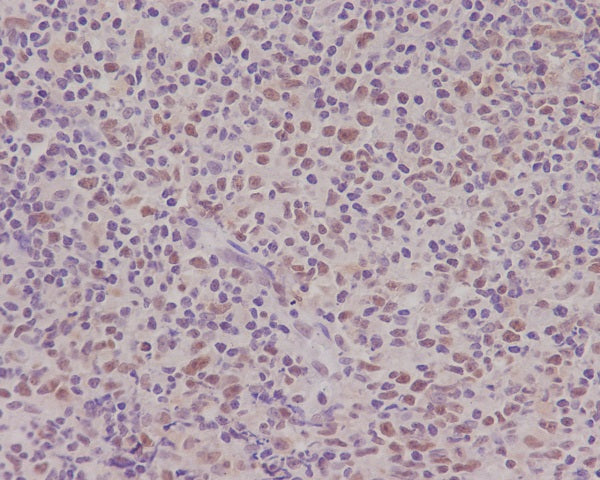 Anti-PMS2 Rabbit Polyclonal Antibody