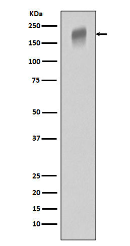 Anti-VEGF Receptor 1 Rabbit Polyclonal Antibody