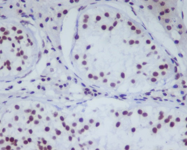 Anti-HDAC1 Rabbit Polyclonal Antibody