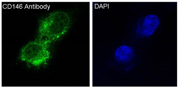 Anti-CD146 Rabbit Polyclonal Antibody