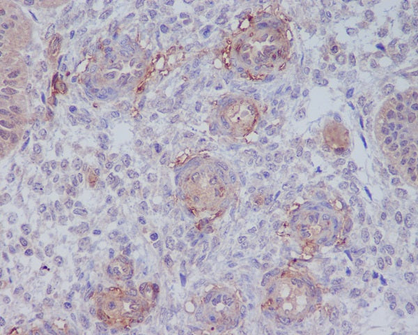 Anti-CD146 Rabbit Polyclonal Antibody