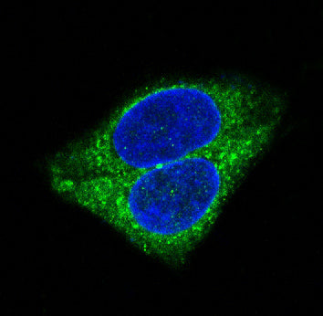 Anti-Synaptophysin Rabbit Polyclonal Antibody