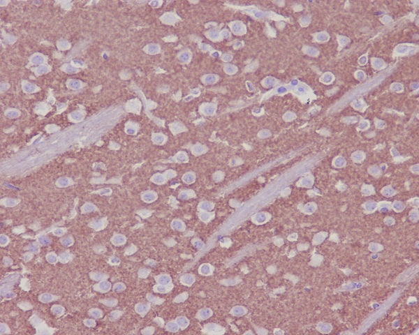 Anti-Synaptophysin Rabbit Polyclonal Antibody