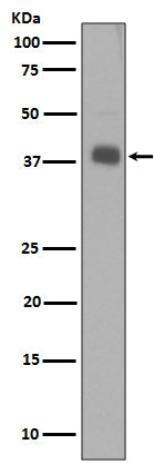 Anti-Synaptophysin Rabbit Polyclonal Antibody
