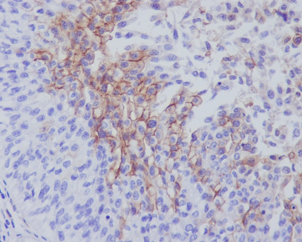 Anti-Thrombomodulin Rabbit Polyclonal Antibody