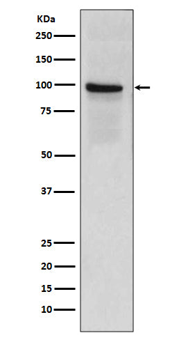 Anti-Thrombomodulin Rabbit Polyclonal Antibody