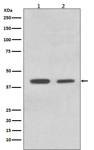 Anti-ACADM Rabbit Polyclonal Antibody