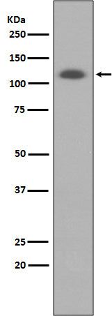 Anti-ABCG1 Rabbit Polyclonal Antibody