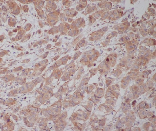 Anti-gamma Tubulin Rabbit Polyclonal Antibody