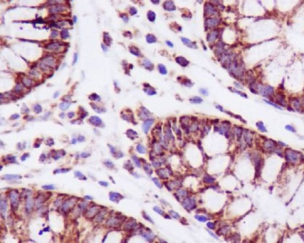 Anti-PBR Rabbit Polyclonal Antibody