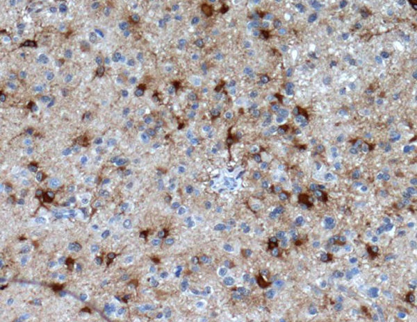 Anti-GFAP Rabbit Polyclonal Antibody
