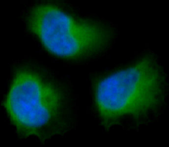 Anti-FAK Rabbit Polyclonal Antibody