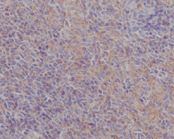 Anti-FAK Rabbit Polyclonal Antibody