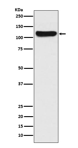 Anti-FAK Rabbit Polyclonal Antibody