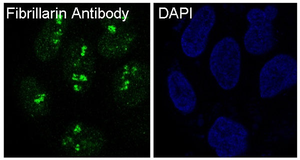 Anti-Fibrillarin Rabbit Polyclonal Antibody