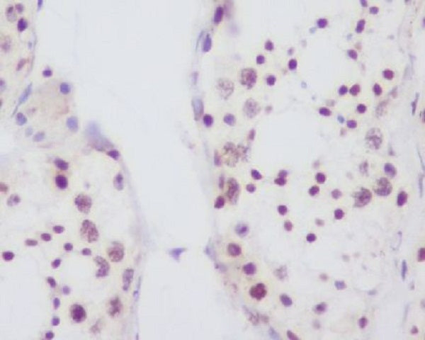 Anti-Fibrillarin Rabbit Polyclonal Antibody
