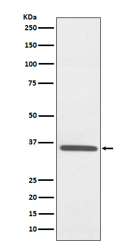 Anti-Fibrillarin Rabbit Polyclonal Antibody