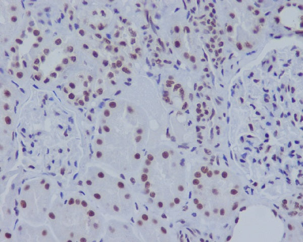 Anti-ASH2L Rabbit Polyclonal Antibody
