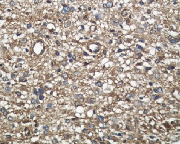 Anti-Midkine Rabbit Polyclonal Antibody