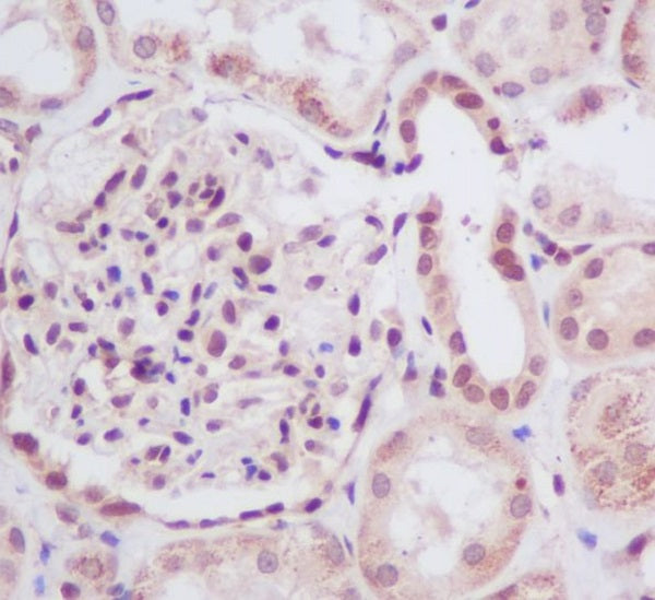 Anti-SUMO Conjugating Enzyme UBC9 Rabbit Polyclonal Antibody
