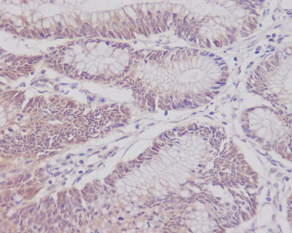 Anti-CD3 epsilon Rabbit Polyclonal Antibody