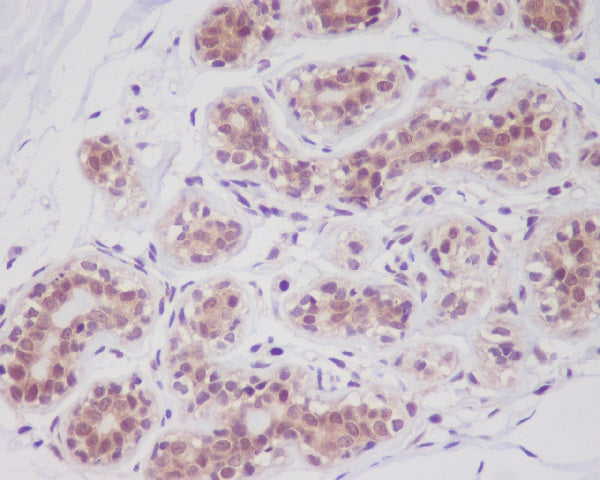 Anti-Cortactin Rabbit Polyclonal Antibody