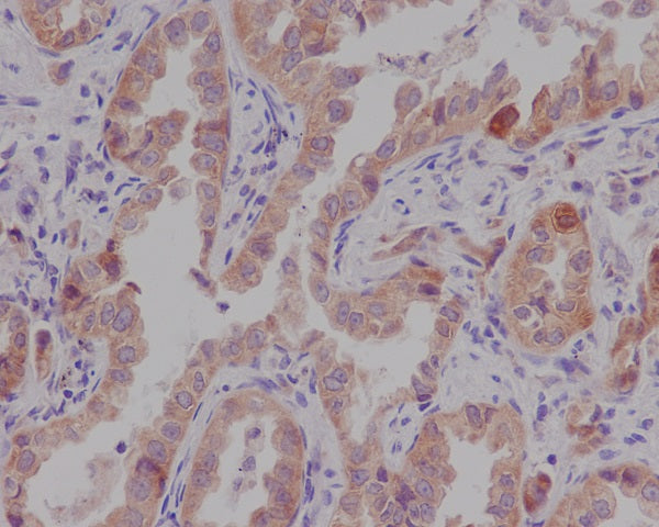 Anti-CTNNA1 Rabbit Polyclonal Antibody