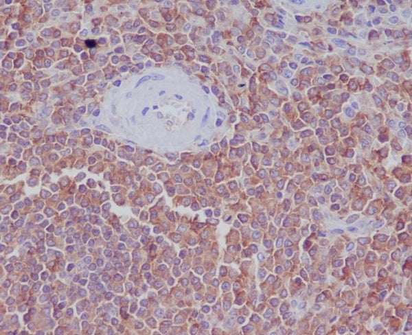 Anti-Radixin Rabbit Polyclonal Antibody