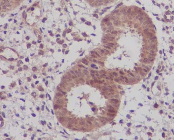 Anti-IKB beta Rabbit Polyclonal Antibody