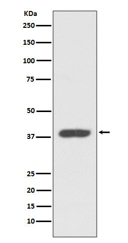 Anti-RDC1 Rabbit Polyclonal Antibody