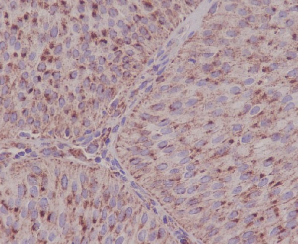 Anti-Asparagine Synthetase Rabbit Polyclonal Antibody