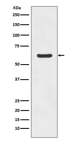 Anti-Asparagine Synthetase Rabbit Polyclonal Antibody