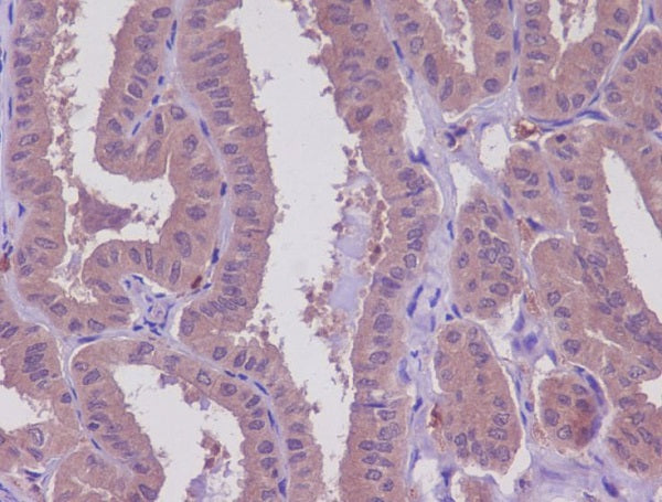 Anti-MEKK2 Rabbit Polyclonal Antibody
