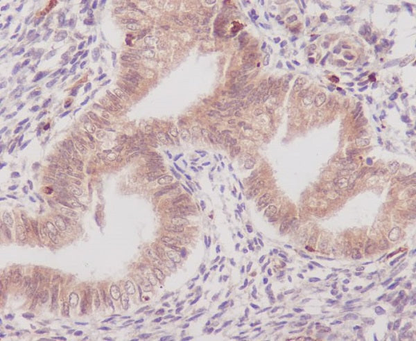 Anti-Cyclooxygenase 1 Rabbit Polyclonal Antibody