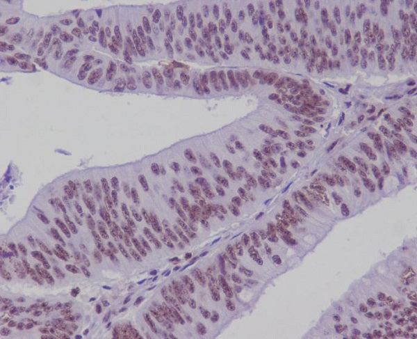 Anti-Transcription Factor 7 Like 2 Rabbit Polyclonal Antibody