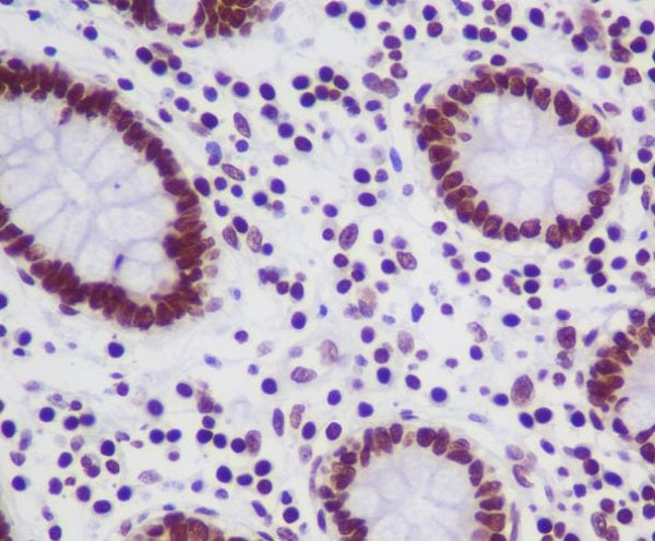 Anti-Topoisomerase I Rabbit Polyclonal Antibody