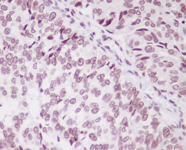 Anti-PARK7/DJ1 Rabbit Polyclonal Antibody