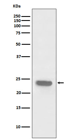 Anti-PARK7/DJ1 Rabbit Polyclonal Antibody