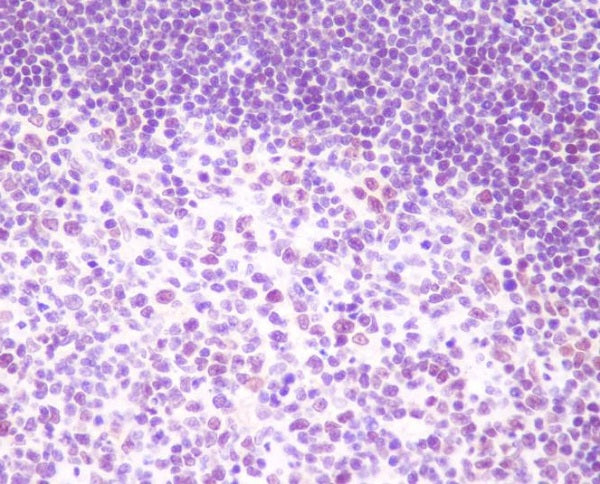 Anti-Rel B Rabbit Polyclonal Antibody