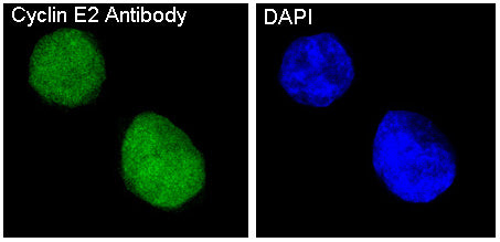 Anti-Cyclin E2 Rabbit Polyclonal Antibody