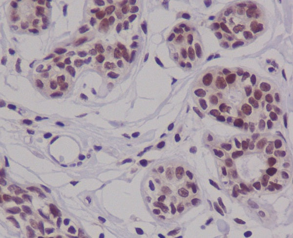 Anti-Cyclin E2 Rabbit Polyclonal Antibody
