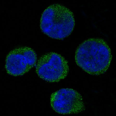 Anti-CDK6 Rabbit Polyclonal Antibody