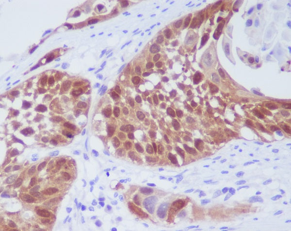 Anti-CDK6 Rabbit Polyclonal Antibody