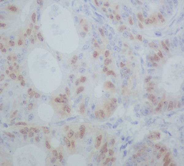 Anti-Cyclin A1/A2 Rabbit Polyclonal Antibody