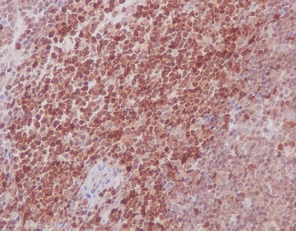 Anti-MEK3/MEK6 Rabbit Polyclonal Antibody