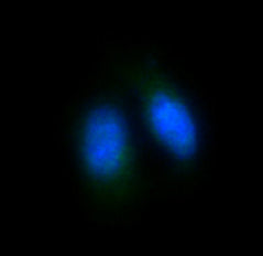 Anti-FOXO4 Rabbit Polyclonal Antibody