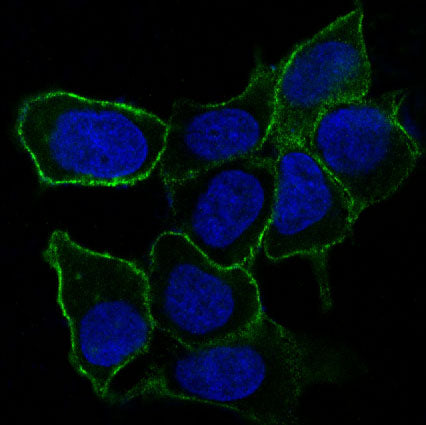 Anti-Integrin alpha 5 Rabbit Polyclonal Antibody